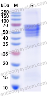 佰乐博生物| AntibodySystem蛋白抗体——Recombinant MeV H/Hemagglutinin glycoprotein Protein, C-His，重组麻疹病毒血凝素蛋白｜科研实验优选蛋白抗体