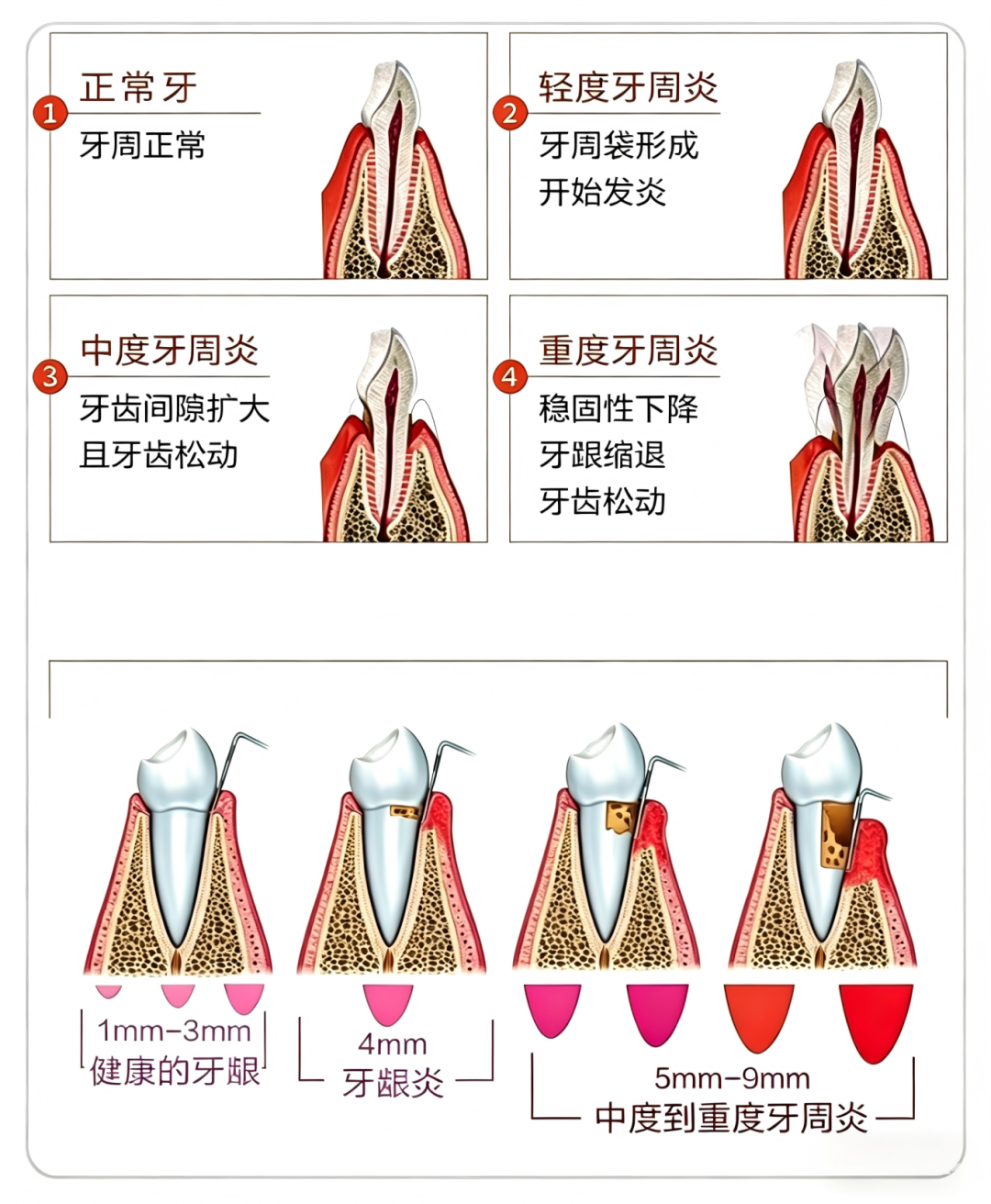 大鼠牙周炎造模｜实操+避坑全套！实验室亲测零失败，直接抄作业