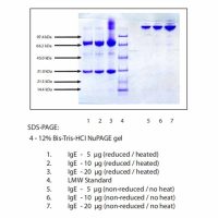 免疫球蛋白E(IgE),人骨髓瘤血浆,Kappa，≥95%(SDS-PAGE), Extinction Coefficient: 1.46，阿拉丁