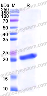 佰乐博生物蛋白抗体------Recombinant Human SOD1 Protein, N-His重组人SOD1蛋白（N-His）｜科研实验优选蛋白抗体