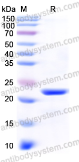 佰乐博生物蛋白抗体------Recombinant Human DHFR Protein, N-His重组人DHFR蛋白（N-His）｜科研实验优选蛋白抗体