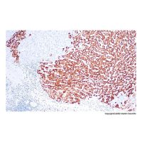 Recombinant Hepatitis B Virus Surface Antigen (Ad/Ay) Antibody，ExactAb™, Validated, Recombinant, 0.15 mg/mL，阿拉丁
