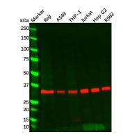 Recombinant MyD88 Antibody，重组, ExactAb™, 已验证, 见COA，阿拉丁