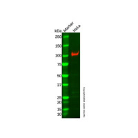 Recombinant Desmocollin 3 Antibody，ExactAb™, Validated, 重组, High performance, 0.2 mg/mL，阿拉丁