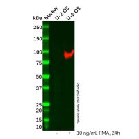 MMP9 antibody,ExactAb™, 已验证, 重组, 见COA,阿拉丁