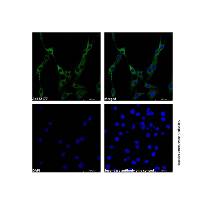 Recombinant TRAF6BP/TAX1BP1 Antibody,ExactAb™, Validated, 重组, 1.0 mg/mL,阿拉丁产品图