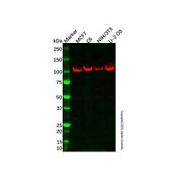 AC5 Antibody,Validated, ExactAb™, 1.0 mg/mL,阿拉丁