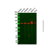 Recombinant PSAP Antibody，重组, ExactAb™, 已验证, 见COA，阿拉丁