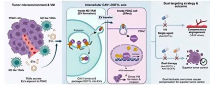 CAV1-DOT1L：胰腺癌血管拟态的关键轴