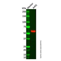 Recombinant Cytokeratin 4 Antibody,ExactAb™, Validated, 重组, High performance, 0.2 mg/mL,阿拉丁
