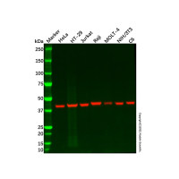 CCR6 Antibody,ExactAb™, Validated, 1.0 mg/mL,阿拉丁