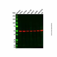 Recombinant MMP11 Antibody，重组, ExactAb™, 已验证, 见COA，阿拉丁