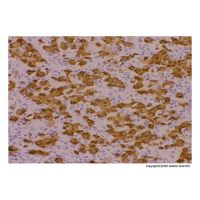 Recombinant ALK Antibody，ExactAb™, Validated, Carrier Free, Recombinant, 0.15 mg/mL，阿拉丁