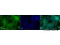 SLP76 Antibody,无载体, ExactAb™, 已验证, 1.0 mg/mL,阿拉丁