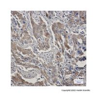 Recombinant STIP1/STI1 Antibody，ExactAb™, Validated, 重组, 0.3 mg/mL，阿拉丁