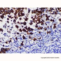 MelanA Mouse mAb，Azide Free, Validated, Carrier Free, 1.0 mg/mL，阿拉丁
