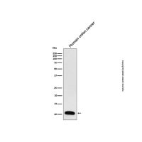 Recombinant Trefoil Factor 3 Antibody,重组, ExactAb™, 已验证, 见COA,阿拉丁