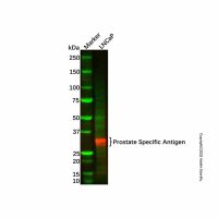 Prostate Specific Antigen Antibody,ExactAb™, 已验证, 无载体, 1.0 mg/mL,阿拉丁