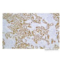 Recombinant Renal Cell Carcinoma (gp200) Antibody，ExactAb™, Validated, Recombinant, 0.48 mg/mL，阿拉丁