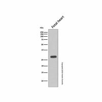 Recombinant Cardiac Troponin I Antibody,重组, ExactAb™, 已验证, 见COA,阿拉丁