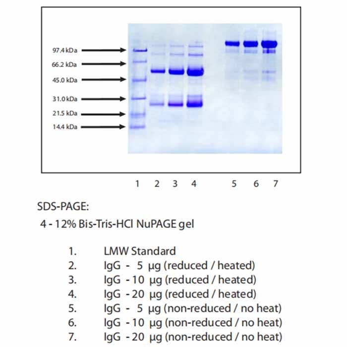 Immunoglobulin G (IgG), Normal Human Plasma，无载体, ≥95%(SDS-PAGE), Extinction Coefficient: 1.36，阿拉丁