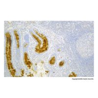 Recombinant VEGF Receptor 2 Antibody,ExactAb™, Validated, Recombinant, 0.12 mg/mL,阿拉丁