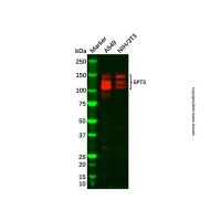 Recombinant SPT5 Antibody,重组, ExactAb™, 敲低验证, 已验证, 见COA,阿拉丁