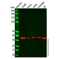 Recombinant NSDHL Antibody，ExactAb™, Validated, Recombinant, 0.8 mg/mL，阿拉丁
