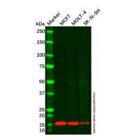 Recombinant CRABP1 Antibody,ExactAb™, Validated, 重组, 0.38 mg/mL,阿拉丁