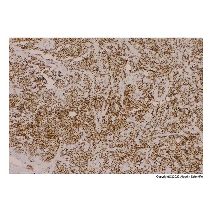 Recombinant MyoD1 Antibody，ExactAb™, Validated, Carrier Free, Recombinant, 1.2 mg/mL，阿拉丁产品图