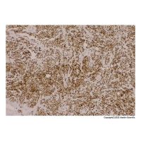 Recombinant MyoD1 Antibody，ExactAb™, Validated, Carrier Free, Recombinant, 1.2 mg/mL，阿拉丁