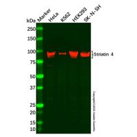 Recombinant Striatin 4 Antibody，ExactAb™, Validated, Recombinant, High performance, 0.3 mg/mL，阿拉丁