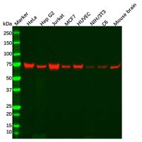 Recombinant NF2/Merlin Antibody,ExactAb™, Validated, 重组, 1.0 mg/mL,阿拉丁
