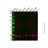 UBE2M/UBC12 Mouse mAb,ExactAb™, 已验证, 见COA,阿拉丁