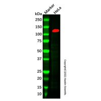 Recombinant SPINK5/LEKTI Antibody,已验证, ExactAb™, 敲低验证, 重组, 见COA,阿拉丁