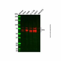 Recombinant RYK Antibody，ExactAb™, Validated, 重组, 0.5 mg/mL，阿拉丁