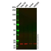 Recombinant DSTN Antibody,重组, ExactAb™, 已验证, 见COA,阿拉丁