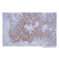 Recombinant TdT Antibody，ExactAb™, Validated, Recombinant, 0.6 mg/mL，阿拉丁