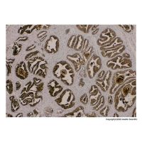 Recombinant Prostate Specific Antigen Antibody，ExactAb™, Validated, Carrier Free, Recombinant, 0.0146 mg/mL，阿拉丁