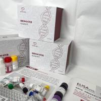 人(Human)血小板第四因子(PF4)ELISA检测试剂盒