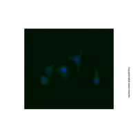 RAB21 Mouse mAb,已验证, 高性能, ExactAb™, 见COA,阿拉丁