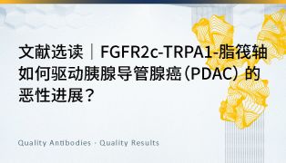 文献选读｜FGFR2c-TRPA1-脂筏轴如何驱动胰腺导管腺癌（PDAC） 的恶性进展？