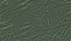 科研攻坚无捷径，优质细胞是核心——人原代肺成纤维细胞（Human Primary Lung Fibroblasts, HLF），解锁肺部研究新可能，为你的实验筑牢根基、加速突破！