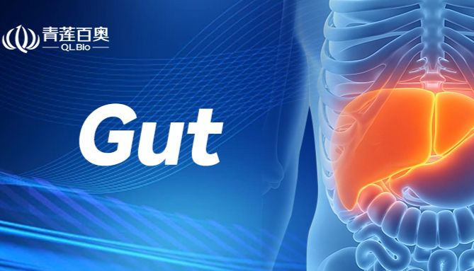 Gut重磅｜南京医科大学王学浩院士团队证实乳酸修饰酶 AARS2 驱动HCC恶性进程与免疫微环境