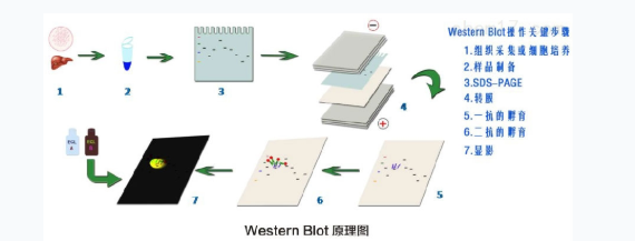 为什么你的血液样本总提不出清晰的蛋白条带？