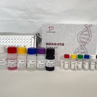 人(Human)丙氨酸氨基转移酶(ALT)ELISA检测试剂盒