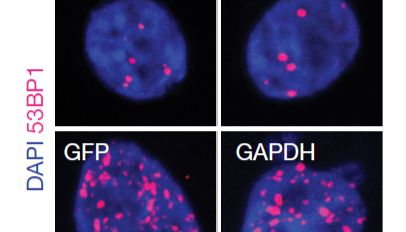 当CRISPR"看"到特定RNA，它就会开始"疯狂杀人"——这项新研究可能会改变癌症治疗
