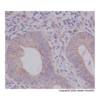 Recombinant eIF5A Antibody，ExactAb™, 已验证, 重组, 高性能, 见COA，阿拉丁