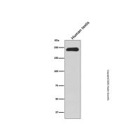 Recombinant smooth muscle Myosin heavy chain 11 Antibody，重组, ExactAb™, 已验证, 见COA，阿拉丁