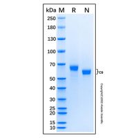 Recombinant Human Complement Component C9 Protein,无动物源,无载体,生物活性,ActiBioPure™,His标签,≥95%(SDS-PAGE),见COA,阿拉丁